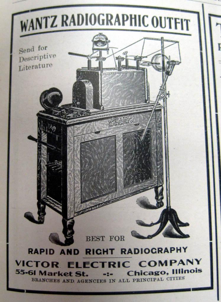 Journal of the IN St Med Assoc 1913 - Victor Wantz